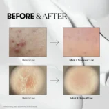 5_aa8a8a9d-0efc-422d-b360-49f4cbb043a7_1