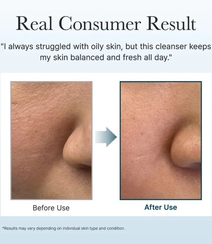 5_d480bca3-9f54-4e05-afe7-615be7d3f77c 5_d480bca3-9f54-4e05-afe7-615be7d3f77c