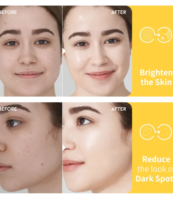 DarkspotvitaminCtoner_amazon-thumbnail_03