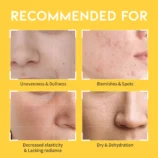 DarkspotvitaminCtoner_amazon-thumbnail_05