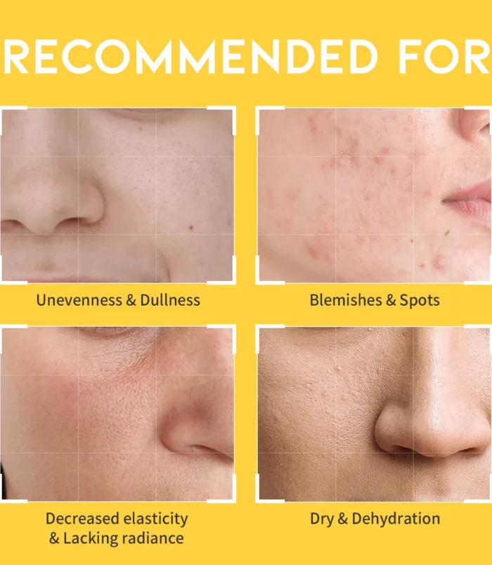 DarkspotvitaminCtoner_amazon-thumbnail_05