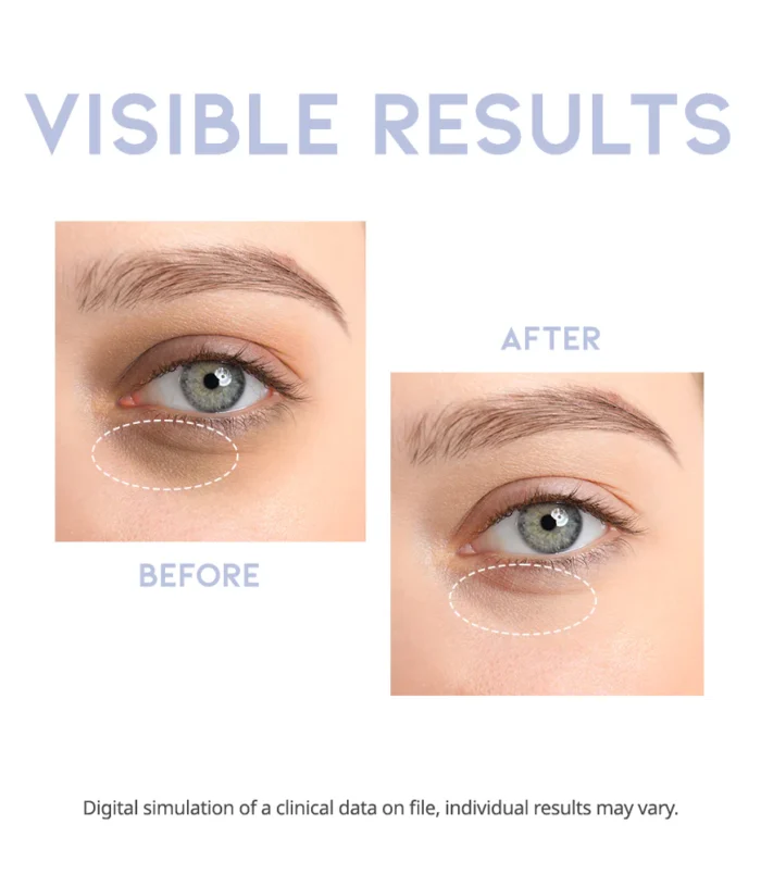 NU0410_IntensiveEyeSerum-A.M_detail_03