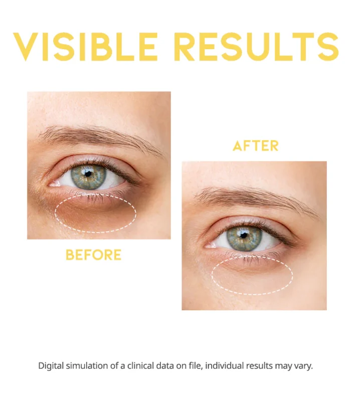 NU0412_DarkCircleEyeSerum_detail_02