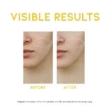 NU0501_DarkSpotVitaminCSerum_detail_01