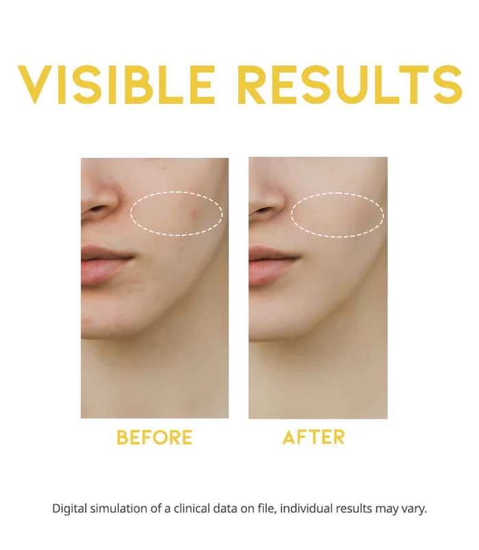 NU0501_DarkSpotVitaminCSerum_detail_01 NU0501_DarkSpotVitaminCSerum_detail_01