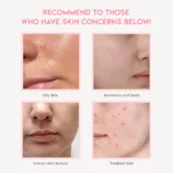 Niacinamide_amazon-thumbnail_03