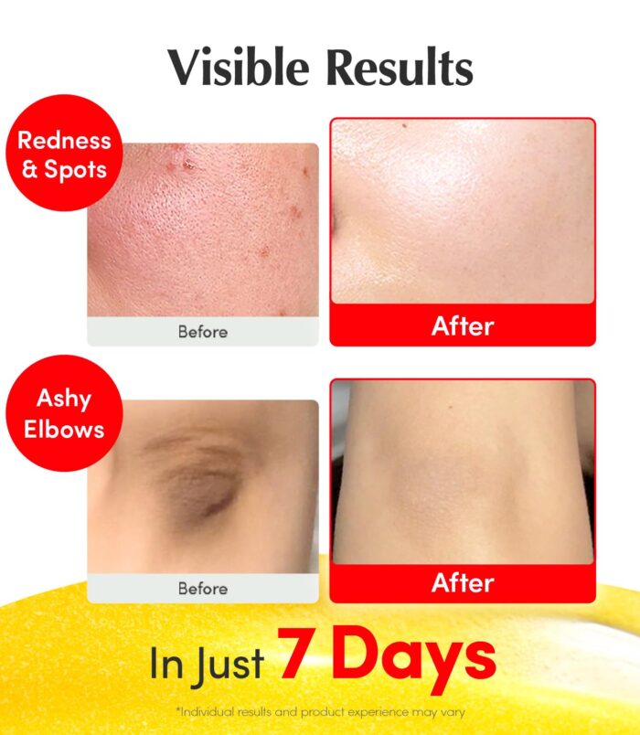 71BmMnxG3wL._SL1500_