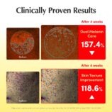 71VSvStetFL._SL1500_