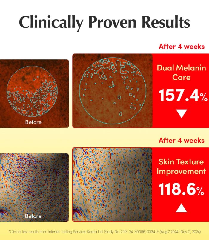 71VSvStetFL._SL1500_