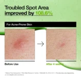 anua-us-ampoule-serum-azelaic-acid-10-hyaluron-redness-soothing-serum-1161173132