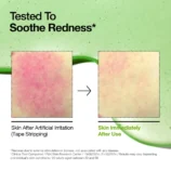 anua-us-ampoule-serum-azelaic-acid-10-hyaluron-redness-soothing-serum-1161173133