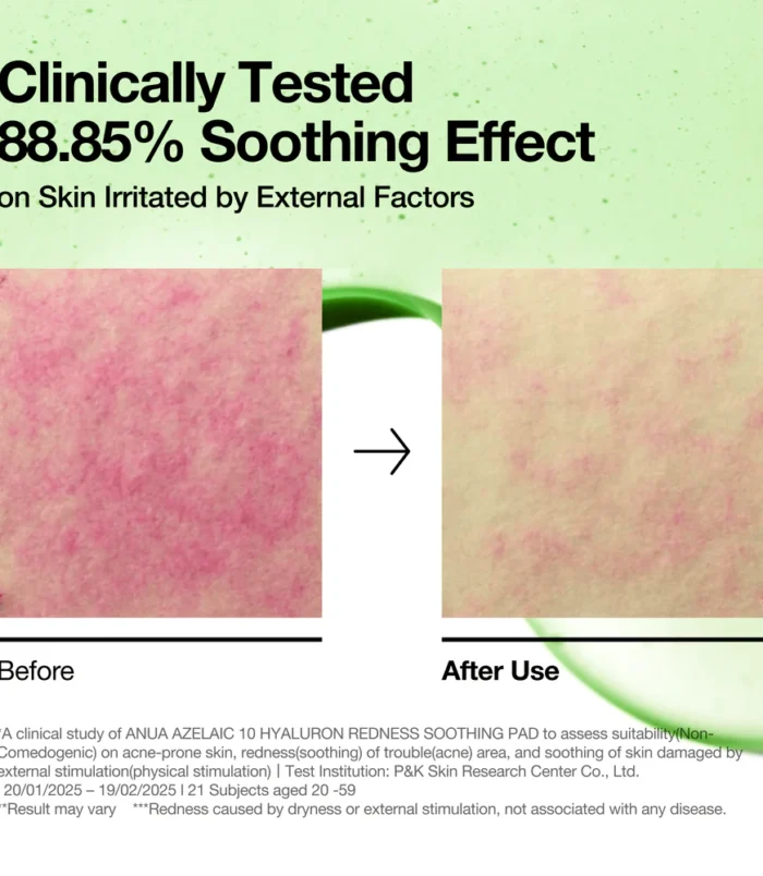 anua-us-toner-90-ea-azelaic-10-hyaluron-redness-soothing-pad-1170826121 anua-us-toner-90-ea-azelaic-10-hyaluron-redness-soothing-pad-1170826121